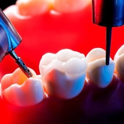 İmplant Diş Fiyatları, Ads Kliniği